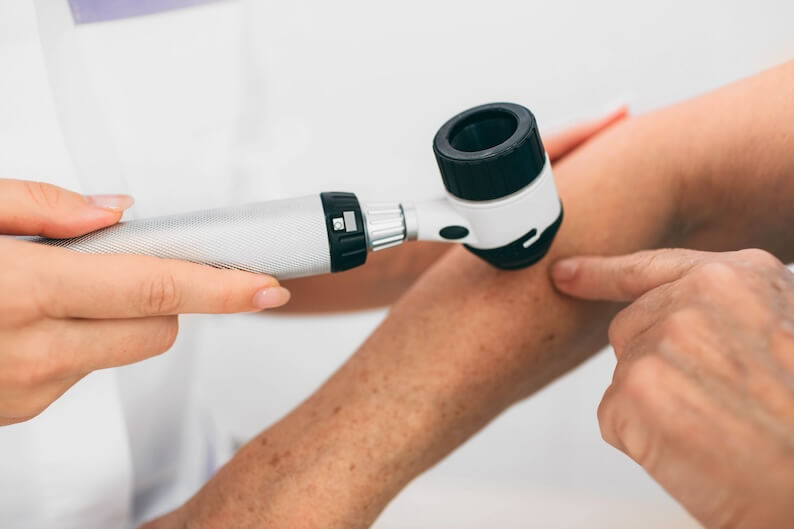 Skin Cancer in Older Adults: Types and Risks