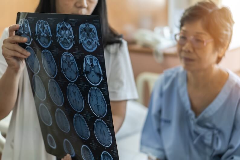 Alzheimer’s and Dementia: What’s the Difference