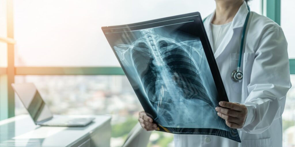 lung-and-respiratory